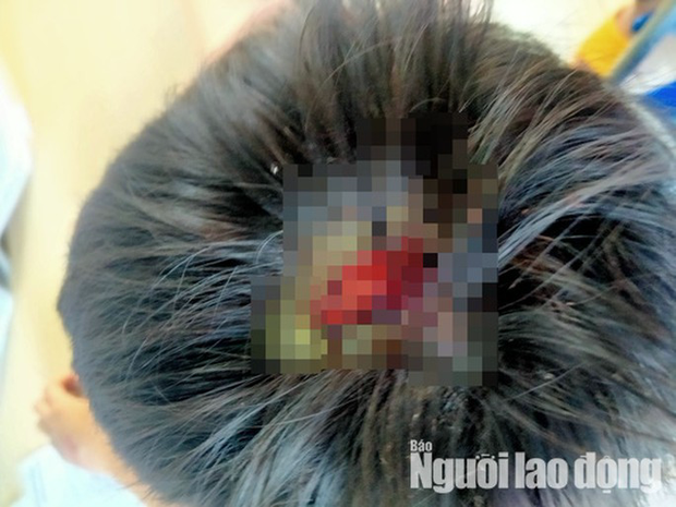 CLIP: Bé 9 tuổi kể việc bị cha bạo hành đến toác đầu, mẻ răng - 1 CLIP: Bé 9 tuổi kể việc bị cha bạo hành đến toác đầu, mẻ răng - 1