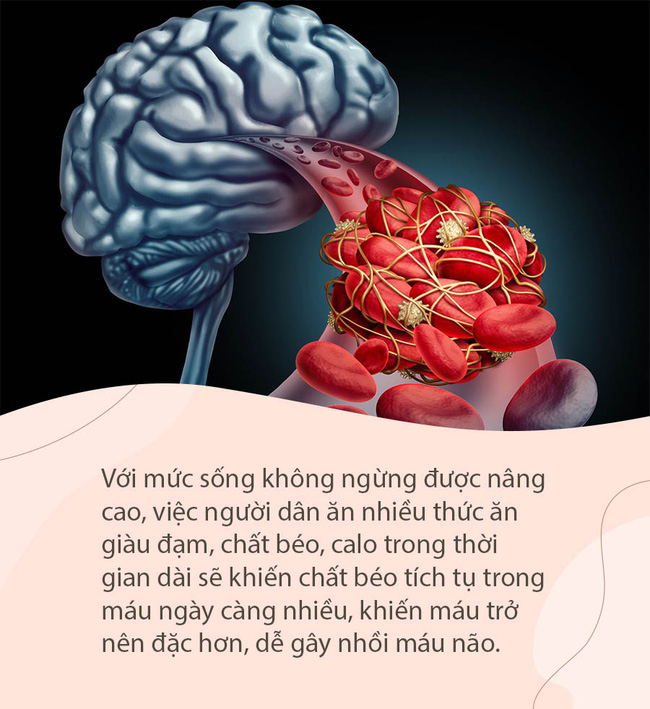 Khi mạch máu não bị tắc nghẽn, sẽ có 4 biểu hiện này ở bàn chân, chú ý để phòng tránh đột quỵ bất ngờ Khi mạch máu não bị tắc nghẽn, sẽ có 4 biểu hiện này ở bàn chân, chú ý để phòng tránh đột quỵ bất ngờ