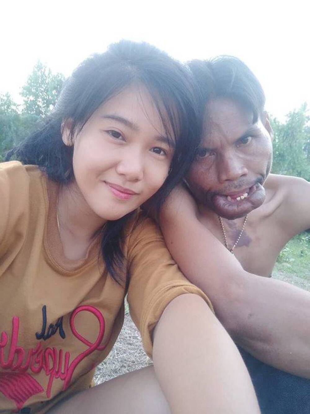 Cuộc hôn nhân không như mơ của chàng trai 'mặt quỷ' và 'vợ tiên' Cuộc hôn nhân không như mơ của chàng trai 'mặt quỷ' và 'vợ tiên'