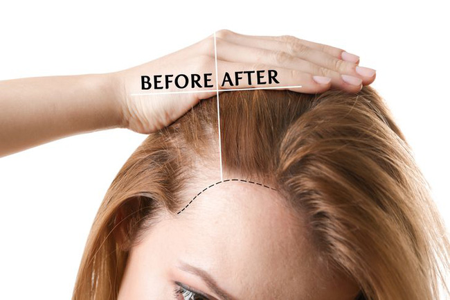 Loại gia vị này là kẻ thù nhan sắc khiến chị em bị lỗ chân to và tăng cân, hạn chế ăn sẽ có lợi rất nhiều - 7 Loại gia vị này là kẻ thù nhan sắc khiến chị em bị lỗ chân to và tăng cân, hạn chế ăn sẽ có lợi rất nhiều - 7