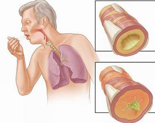 Sự thật về đông trùng hạ thảo: Có thật sự 'thần thánh' như lời đồn? Có tác dụng với bệnh ung thư không? - 4 Sự thật về đông trùng hạ thảo: Có thật sự 'thần thánh' như lời đồn? Có tác dụng với bệnh ung thư không? - 4