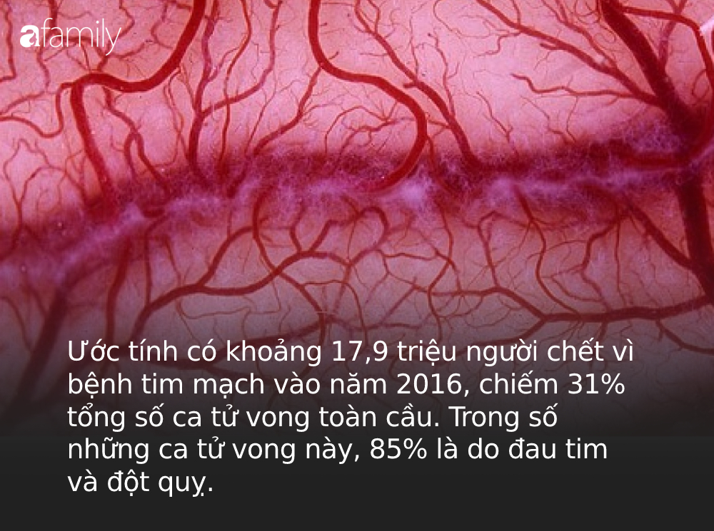 Không phải ung thư, WHO cảnh báo đây mới là căn bệnh gây tử vong số 1 toàn cầu, 80% có thể ngăn chặn nếu thực hiện 4 thói quen tốt Không phải ung thư, WHO cảnh báo đây mới là căn bệnh gây tử vong số 1 toàn cầu, 80% có thể ngăn chặn nếu thực hiện 4 thói quen tốt