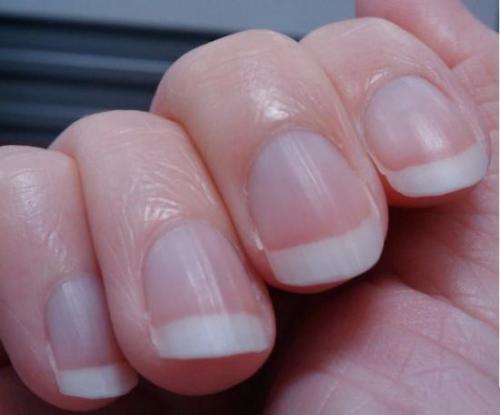Người đàn ông đột ngột phát hiện ung thư phổi, BS nhắc nhở: 4 dấu hiệu này trên tay nghĩa là ung thư đã đến giai đoạn giữa và cuối - 1 Người đàn ông đột ngột phát hiện ung thư phổi, BS nhắc nhở: 4 dấu hiệu này trên tay nghĩa là ung thư đã đến giai đoạn giữa và cuối - 1