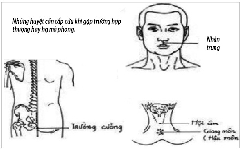 Thượng mã phong - Trạng thái nguy hiểm khi 'yêu' Thượng mã phong - Trạng thái nguy hiểm khi 'yêu'