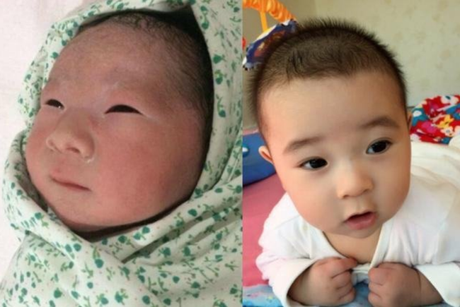Mẹ buồn lòng vì sinh con gái mà xấu ngoài sức tưởng tượng, 5 năm sau cô bé có màn lột xác ngoạn mục ai cũng phải tấm tắc khen - 2 Mẹ buồn lòng vì sinh con gái mà xấu ngoài sức tưởng tượng, 5 năm sau cô bé có màn lột xác ngoạn mục ai cũng phải tấm tắc khen - 2