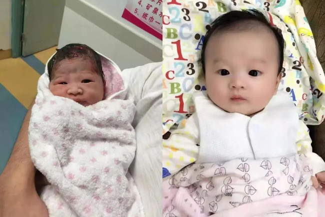 Mẹ buồn lòng vì sinh con gái mà xấu ngoài sức tưởng tượng, 5 năm sau cô bé có màn lột xác ngoạn mục ai cũng phải tấm tắc khen - 4 Mẹ buồn lòng vì sinh con gái mà xấu ngoài sức tưởng tượng, 5 năm sau cô bé có màn lột xác ngoạn mục ai cũng phải tấm tắc khen - 4