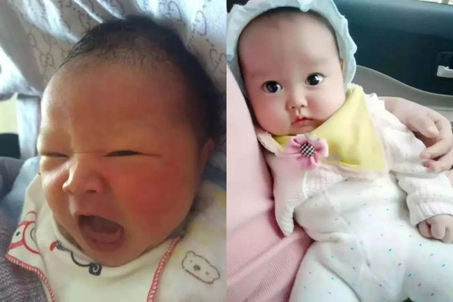Mẹ buồn lòng vì sinh con gái mà xấu ngoài sức tưởng tượng, 5 năm sau cô bé có màn lột xác ngoạn mục ai cũng phải tấm tắc khen - 7 Mẹ buồn lòng vì sinh con gái mà xấu ngoài sức tưởng tượng, 5 năm sau cô bé có màn lột xác ngoạn mục ai cũng phải tấm tắc khen - 7