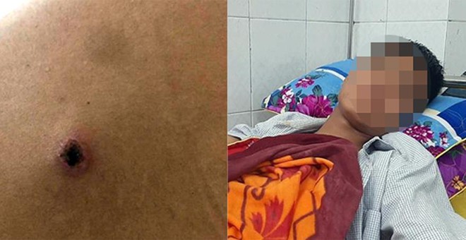 Điều tra vụ nam thanh niên bị bắn khi đi ăn đêm Điều tra vụ nam thanh niên bị bắn khi đi ăn đêm