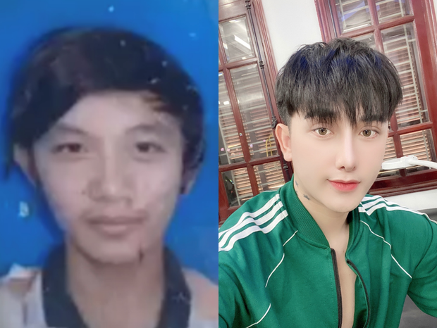 Đi xin việc bị từ chối vì ngoại hình, chàng trai quyết tâm 'đập mặt đi xây lại' - 1 Đi xin việc bị từ chối vì ngoại hình, chàng trai quyết tâm 'đập mặt đi xây lại' - 1