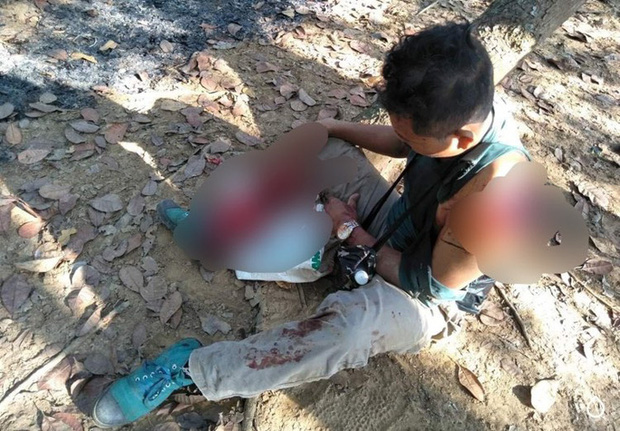 Kinh hãi người đàn ông bị bò tót húc nát vai và chân Kinh hãi người đàn ông bị bò tót húc nát vai và chân