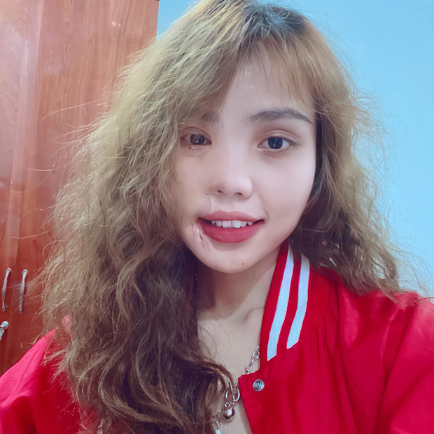 Cô gái bị chồng sắp cưới tạt axit xuất hiện với tạo hình mới lạ trong bộ ảnh đậm chất nghệ thuật - 1 Cô gái bị chồng sắp cưới tạt axit xuất hiện với tạo hình mới lạ trong bộ ảnh đậm chất nghệ thuật - 1