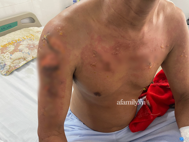 Nạn nhân sống sót trong vụ cháy 6 người chết ở Thủ Đức hối hận: 'Lẽ ra tôi phải đánh thức mọi người dậy hết…' - 5 Nạn nhân sống sót trong vụ cháy 6 người chết ở Thủ Đức hối hận: 'Lẽ ra tôi phải đánh thức mọi người dậy hết…' - 5
