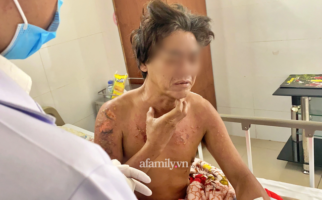 Nạn nhân sống sót trong vụ cháy 6 người chết ở Thủ Đức hối hận: 'Lẽ ra tôi phải đánh thức mọi người dậy hết…' - 3 Nạn nhân sống sót trong vụ cháy 6 người chết ở Thủ Đức hối hận: 'Lẽ ra tôi phải đánh thức mọi người dậy hết…' - 3