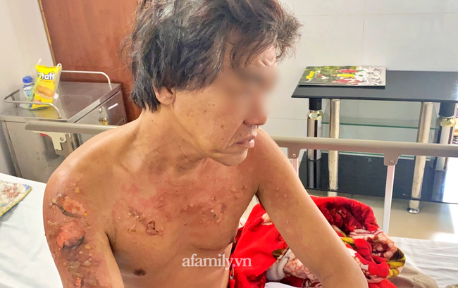 Nạn nhân sống sót trong vụ cháy 6 người chết ở Thủ Đức hối hận: 'Lẽ ra tôi phải đánh thức mọi người dậy hết…' - 1 Nạn nhân sống sót trong vụ cháy 6 người chết ở Thủ Đức hối hận: 'Lẽ ra tôi phải đánh thức mọi người dậy hết…' - 1