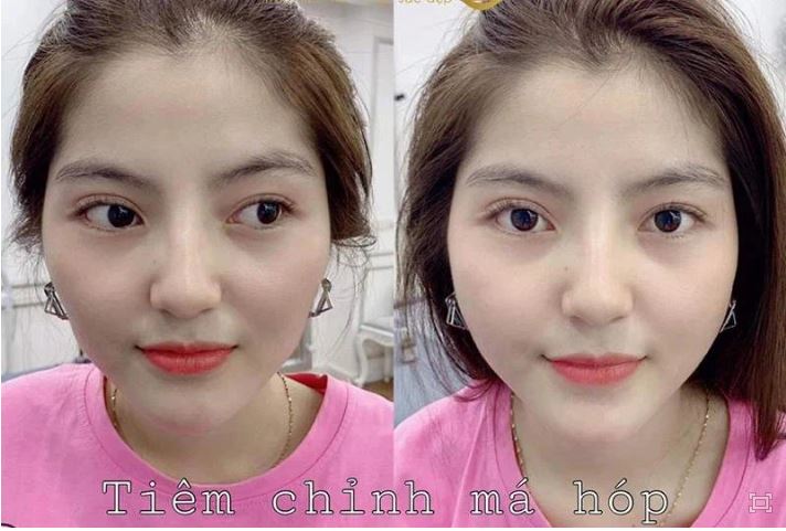 Xôn xao ảnh bạn gái tin đồn của Quang Hải đi chỉnh sửa nhan sắc, gương mặt 'before' gây chú ý - 2 Xôn xao ảnh bạn gái tin đồn của Quang Hải đi chỉnh sửa nhan sắc, gương mặt 'before' gây chú ý - 2