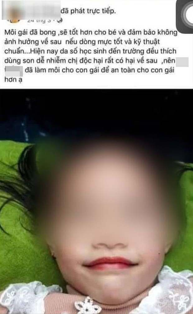Đại diện thẩm mỹ viện phun môi cho bé gái 5 tuổi lên tiếng: 'Con gái là ngọc ngà trong nhà nên đâu có chuyện làm những gì không tốt cho bé' Đại diện thẩm mỹ viện phun môi cho bé gái 5 tuổi lên tiếng: 'Con gái là ngọc ngà trong nhà nên đâu có chuyện làm những gì không tốt cho bé'