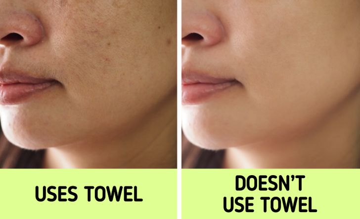 Nếu biết lý do khiến làn da ngày càng nhăn nheo mụn nhọt, bạn sẽ 'cạch' đến già việc dùng khăn lau khô mặt - 1 Nếu biết lý do khiến làn da ngày càng nhăn nheo mụn nhọt, bạn sẽ 'cạch' đến già việc dùng khăn lau khô mặt - 1