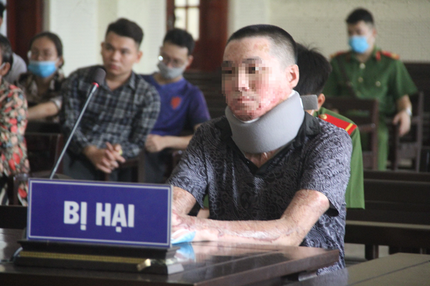 Tạt xăng đốt cháy đồng nghiệp cũ vì chậm trả nợ 2,5 triệu đồng - 1 Tạt xăng đốt cháy đồng nghiệp cũ vì chậm trả nợ 2,5 triệu đồng - 1