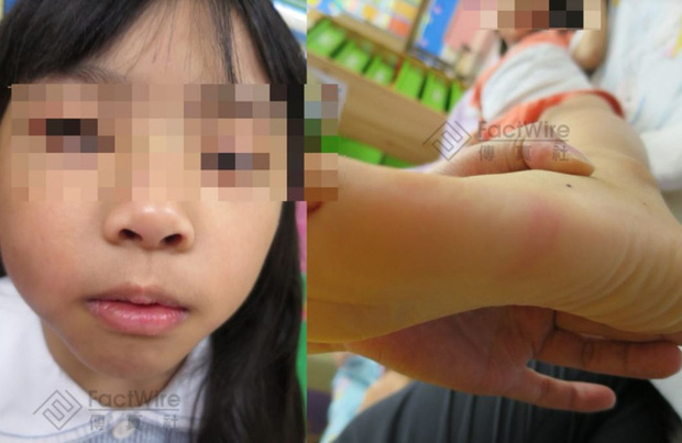 Bé gái 5 tuổi bị bố và mẹ kế bạo hành đến chết: Bị ném lên trần nhà, cơ thể kiệt quệ như người già, chết cũng không được no bụng - 4 Bé gái 5 tuổi bị bố và mẹ kế bạo hành đến chết: Bị ném lên trần nhà, cơ thể kiệt quệ như người già, chết cũng không được no bụng - 4