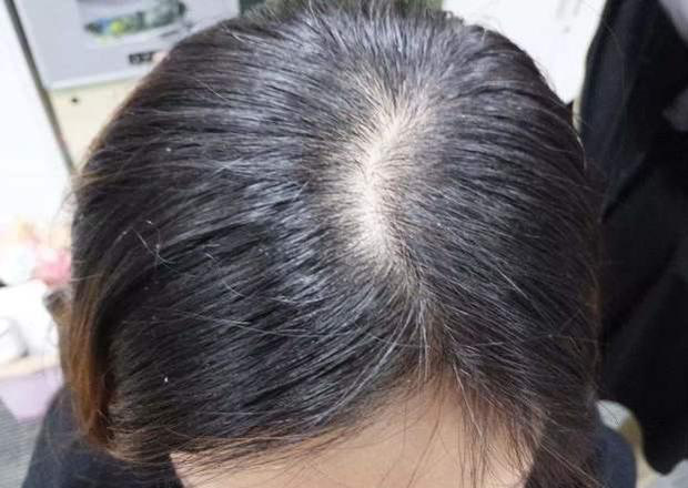 Lông ở 3 vùng trên cơ thể càng chắc khỏe thì bạn càng sống lâu, đặc biệt là cái đầu tiên nhưng nhiều người không biết lại tự ti vì nó - 1 Lông ở 3 vùng trên cơ thể càng chắc khỏe thì bạn càng sống lâu, đặc biệt là cái đầu tiên nhưng nhiều người không biết lại tự ti vì nó - 1