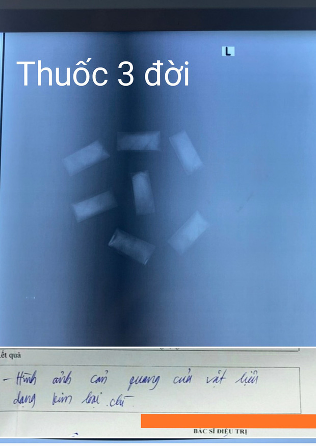 Người nhà giấu nhẹm việc dùng thuốc 'nhà tôi 3 đời', bác sĩ loay hoay mãi không cứu được bệnh nhân Người nhà giấu nhẹm việc dùng thuốc 'nhà tôi 3 đời', bác sĩ loay hoay mãi không cứu được bệnh nhân
