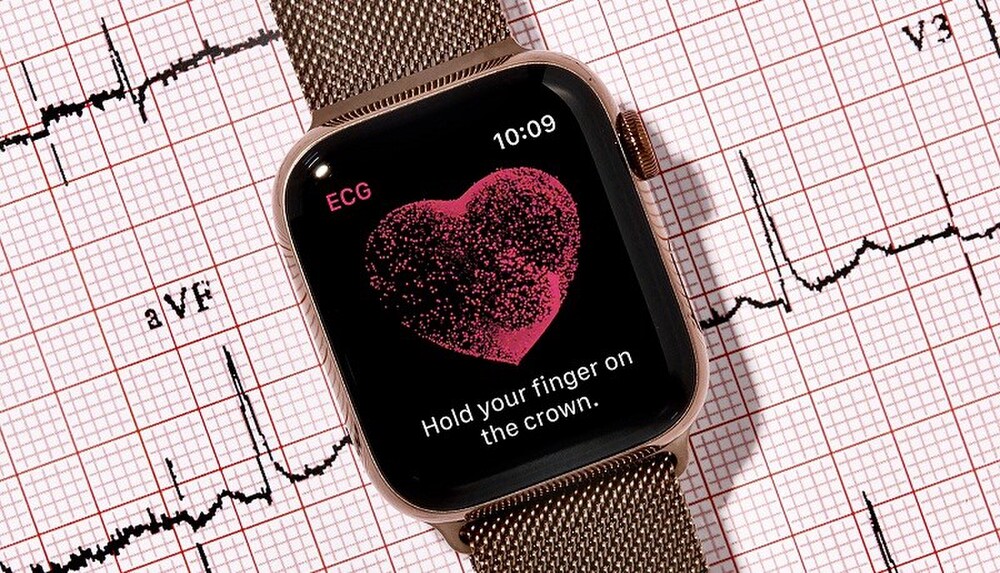 Tính năng điện tâm đồ trên Apple Watch sắp dùng được ở Việt Nam - 1 Tính năng điện tâm đồ trên Apple Watch sắp dùng được ở Việt Nam - 1