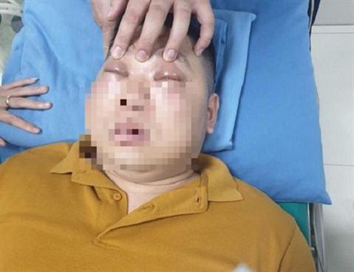 Sốc phản vệ vì thái một củ hành: Nỗi ám ảnh khác Sốc phản vệ vì thái một củ hành: Nỗi ám ảnh khác