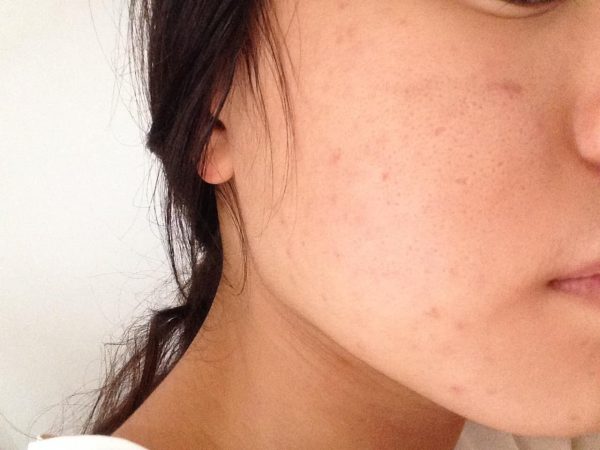 3 điều khiến bạn già hơn hẳn so với tuổi, mà chỉ xuất phát từ một nguyên nhân duy nhất - 3 3 điều khiến bạn già hơn hẳn so với tuổi, mà chỉ xuất phát từ một nguyên nhân duy nhất - 3