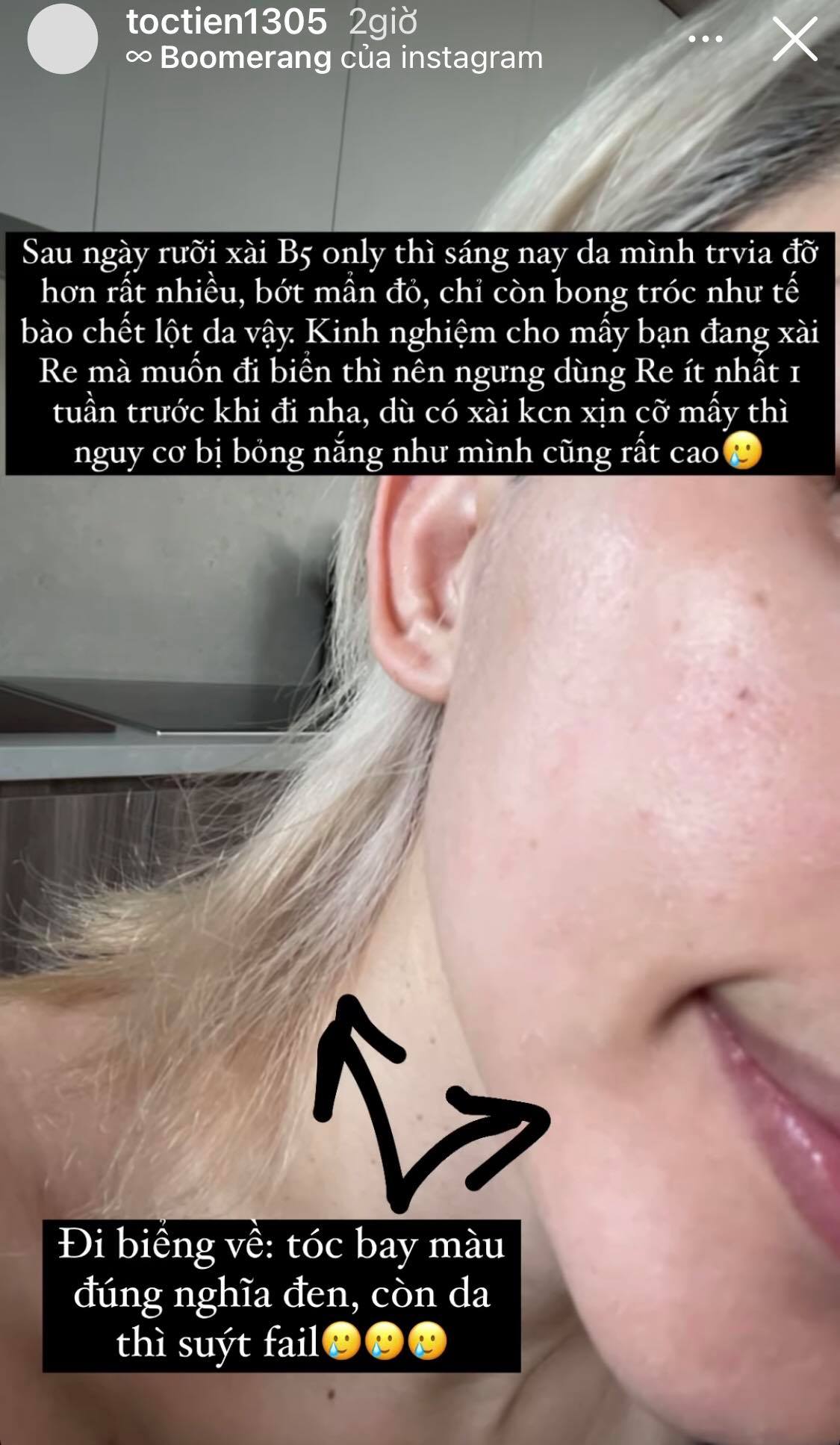 Tóc Tiên chịu cảnh bong tróc mẩn đỏ do dùng retinol, nhờ bôi chất này mà cứu nguy cho cả da mặt - 2 Tóc Tiên chịu cảnh bong tróc mẩn đỏ do dùng retinol, nhờ bôi chất này mà cứu nguy cho cả da mặt - 2
