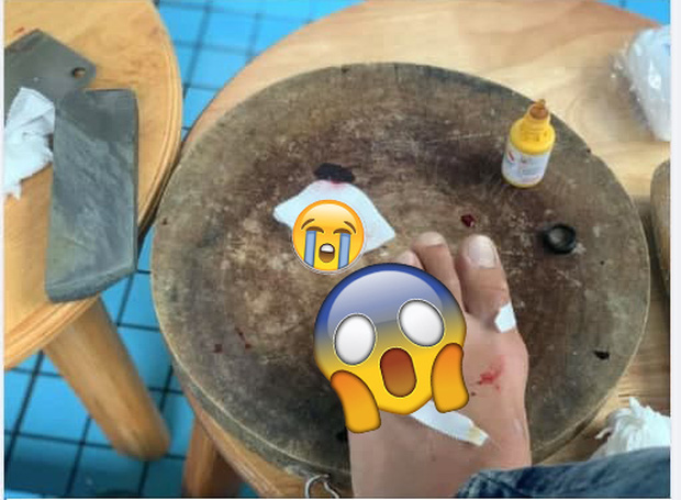 Buồn chuyện tình cảm, nam thanh niên livestream lấy dao chặt phăng ngón chân Buồn chuyện tình cảm, nam thanh niên livestream lấy dao chặt phăng ngón chân