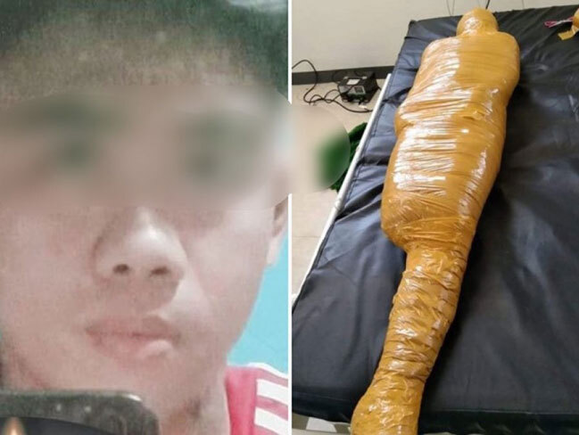 Nạn nhân tai nạn bị quấn như xác ướp vì bệnh viện sợ lây Covid-19 Nạn nhân tai nạn bị quấn như xác ướp vì bệnh viện sợ lây Covid-19