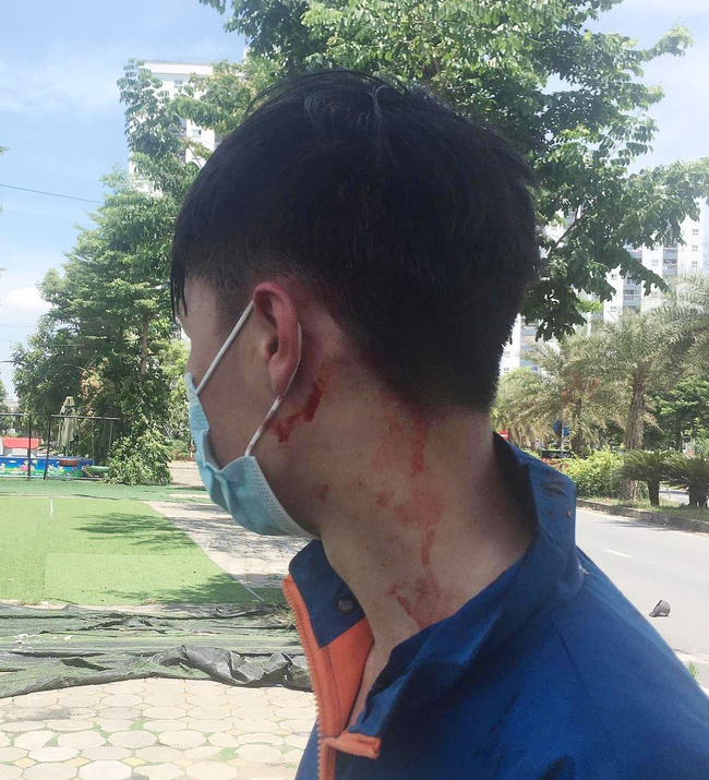 Hà Nội: Đã bắt được nhóm cướp giật điện thoại, đâm nam shipper ở khu đô thị Thanh Hà - 2 Hà Nội: Đã bắt được nhóm cướp giật điện thoại, đâm nam shipper ở khu đô thị Thanh Hà - 2