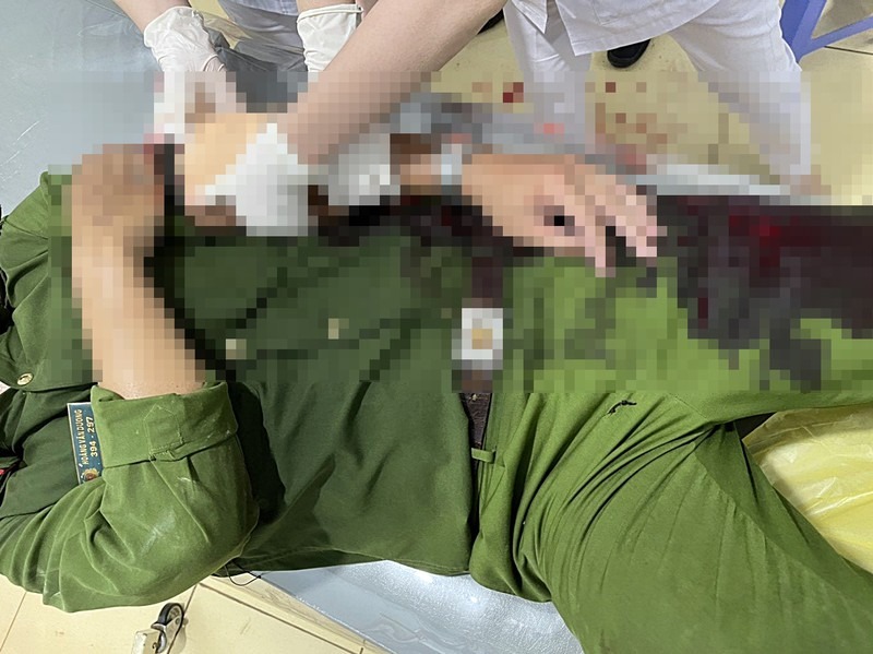 Khẩn trương truy bắt đối tượng vi phạm phòng dịch còn chém gần đứt cánh tay một thượng uý công an - 1 Khẩn trương truy bắt đối tượng vi phạm phòng dịch còn chém gần đứt cánh tay một thượng uý công an - 1