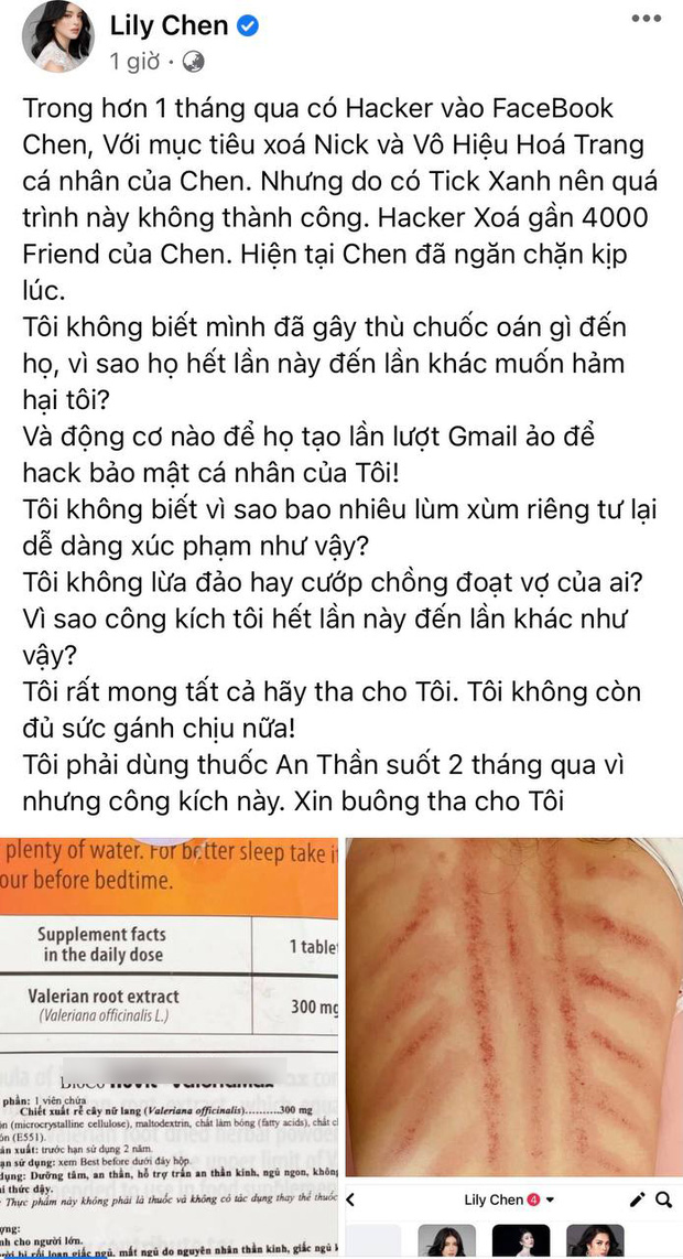 Sau ồn ào chung bồ với Ngọc Trinh, Lily Chen bỗng đăng ảnh lưng rướm máu, tiết lộ dùng thuốc an thần suốt 2 tháng qua Sau ồn ào chung bồ với Ngọc Trinh, Lily Chen bỗng đăng ảnh lưng rướm máu, tiết lộ dùng thuốc an thần suốt 2 tháng qua