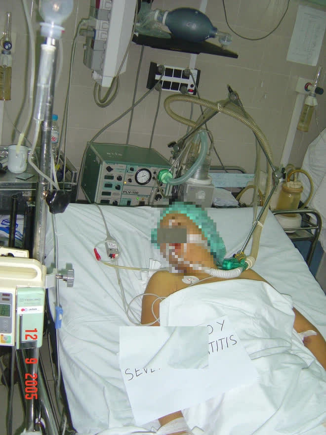 Lan truyền cách tự chữa Covid-19 trên mạng: GĐ Trung tâm chống độc BV Bạch Mai cảnh báo ngộ độc thuốc hạ sốt Lan truyền cách tự chữa Covid-19 trên mạng: GĐ Trung tâm chống độc BV Bạch Mai cảnh báo ngộ độc thuốc hạ sốt