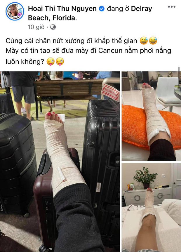 Hoa hậu Thu Hoài gặp chấn thương nghiêm trọng ở Mỹ, Hari Won - Mai Hồ cùng dàn sao Việt đồng loạt lo lắng hỏi thăm Hoa hậu Thu Hoài gặp chấn thương nghiêm trọng ở Mỹ, Hari Won - Mai Hồ cùng dàn sao Việt đồng loạt lo lắng hỏi thăm