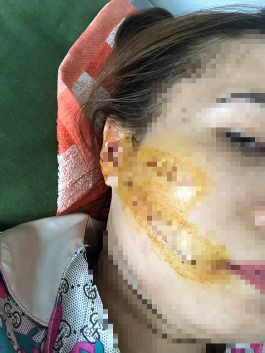 Khởi tố người chồng chém vợ là nữ công nhân thương tích 42% Khởi tố người chồng chém vợ là nữ công nhân thương tích 42%