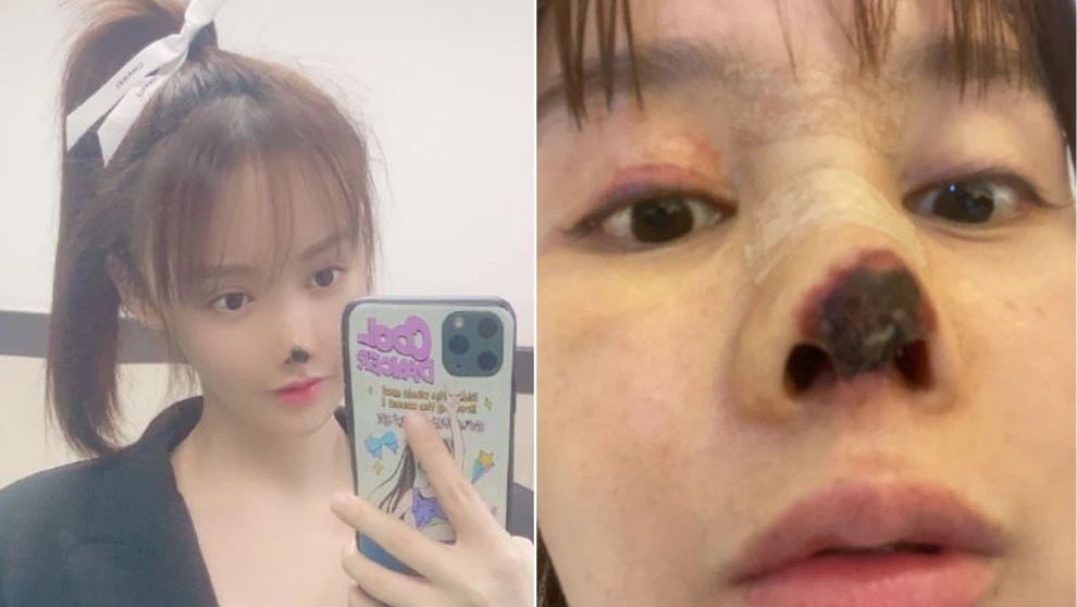 Hot girl bị rụng mũi khiến dân Trung Quốc 'nổi điên': Điều phẫn nộ nhất lại nằm ở bản án 'không tin nổi' Hot girl bị rụng mũi khiến dân Trung Quốc 'nổi điên': Điều phẫn nộ nhất lại nằm ở bản án 'không tin nổi'