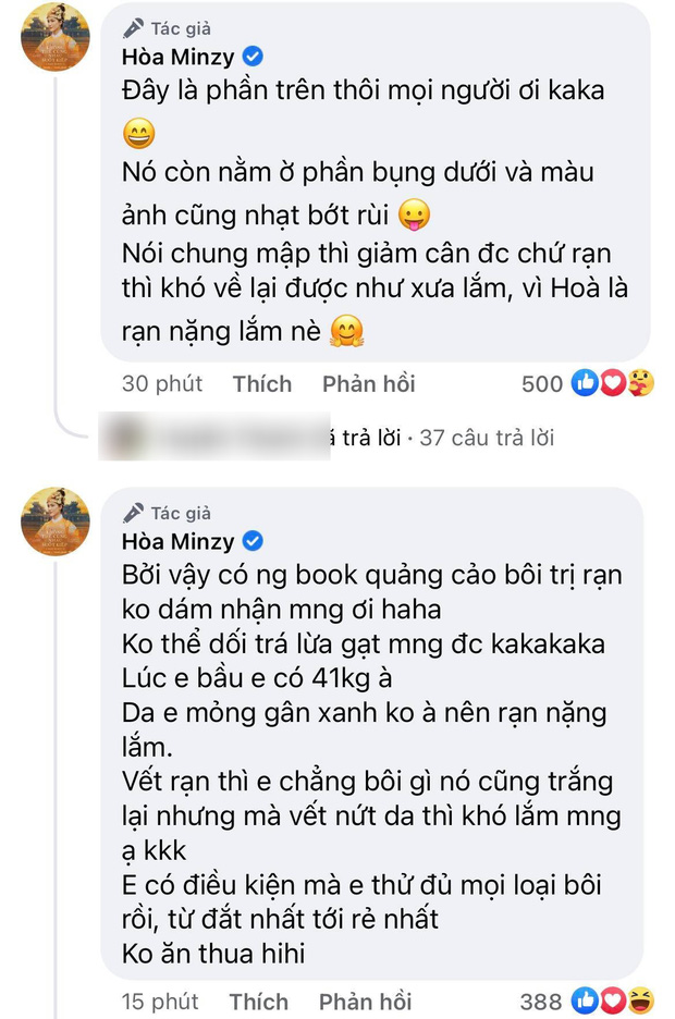 Lần đầu Hoà Minzy khoe cận chiếc bụng bầu đầy vết rạn thâm đen, chỉ những ai làm mẹ mới hiểu hết loạt ảnh khó tin này! - 5 Lần đầu Hoà Minzy khoe cận chiếc bụng bầu đầy vết rạn thâm đen, chỉ những ai làm mẹ mới hiểu hết loạt ảnh khó tin này! - 5