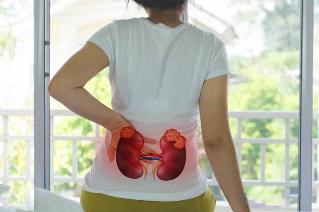 7 thói quen bị các chuyên gia liệt vào nhóm 'sát thủ' hại thận, điều cuối cùng ai cũng mắc phải 7 thói quen bị các chuyên gia liệt vào nhóm 'sát thủ' hại thận, điều cuối cùng ai cũng mắc phải