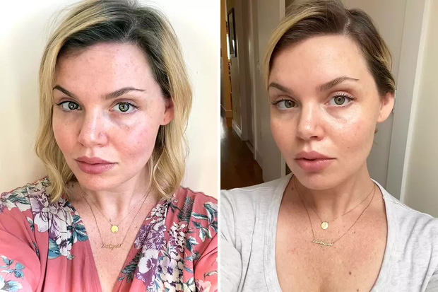 Có giá chưa đến 500K, chai serum vitamin C này có gì mà nhận về hơn 57.000 đánh giá 5 sao trên Amazon? - 1 Có giá chưa đến 500K, chai serum vitamin C này có gì mà nhận về hơn 57.000 đánh giá 5 sao trên Amazon? - 1