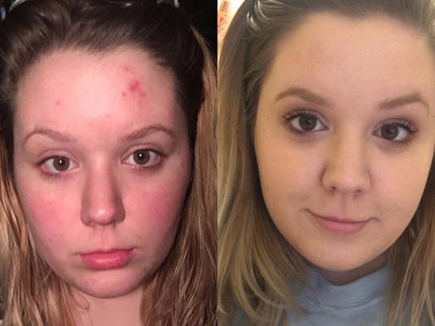 Có giá chưa đến 500K, chai serum vitamin C này có gì mà nhận về hơn 57.000 đánh giá 5 sao trên Amazon? - 2 Có giá chưa đến 500K, chai serum vitamin C này có gì mà nhận về hơn 57.000 đánh giá 5 sao trên Amazon? - 2