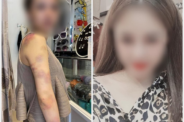 Bị tố bạo hành vợ xuyên đêm ở Yên Bái, người chồng lên tiếng: Có tát, đấm vào đầu, vai nhưng không đánh, nhốt Bị tố bạo hành vợ xuyên đêm ở Yên Bái, người chồng lên tiếng: Có tát, đấm vào đầu, vai nhưng không đánh, nhốt