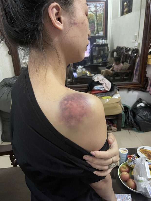 Bị tố bạo hành vợ xuyên đêm ở Yên Bái, người chồng lên tiếng: Có tát, đấm vào đầu, vai nhưng không đánh, nhốt - 1 Bị tố bạo hành vợ xuyên đêm ở Yên Bái, người chồng lên tiếng: Có tát, đấm vào đầu, vai nhưng không đánh, nhốt - 1