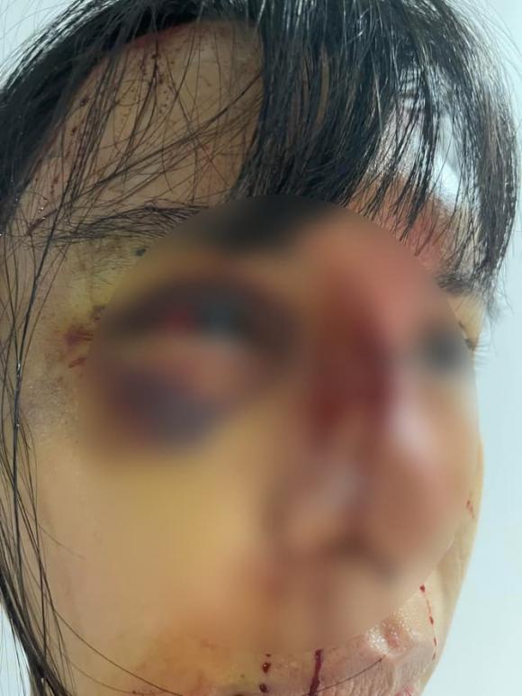 Mẹ đẻ báo công an tới giải cứu siêu mẫu Khả Trang sau 2 ngày bị giam lỏng, bạo hành dã man - 5 Mẹ đẻ báo công an tới giải cứu siêu mẫu Khả Trang sau 2 ngày bị giam lỏng, bạo hành dã man - 5