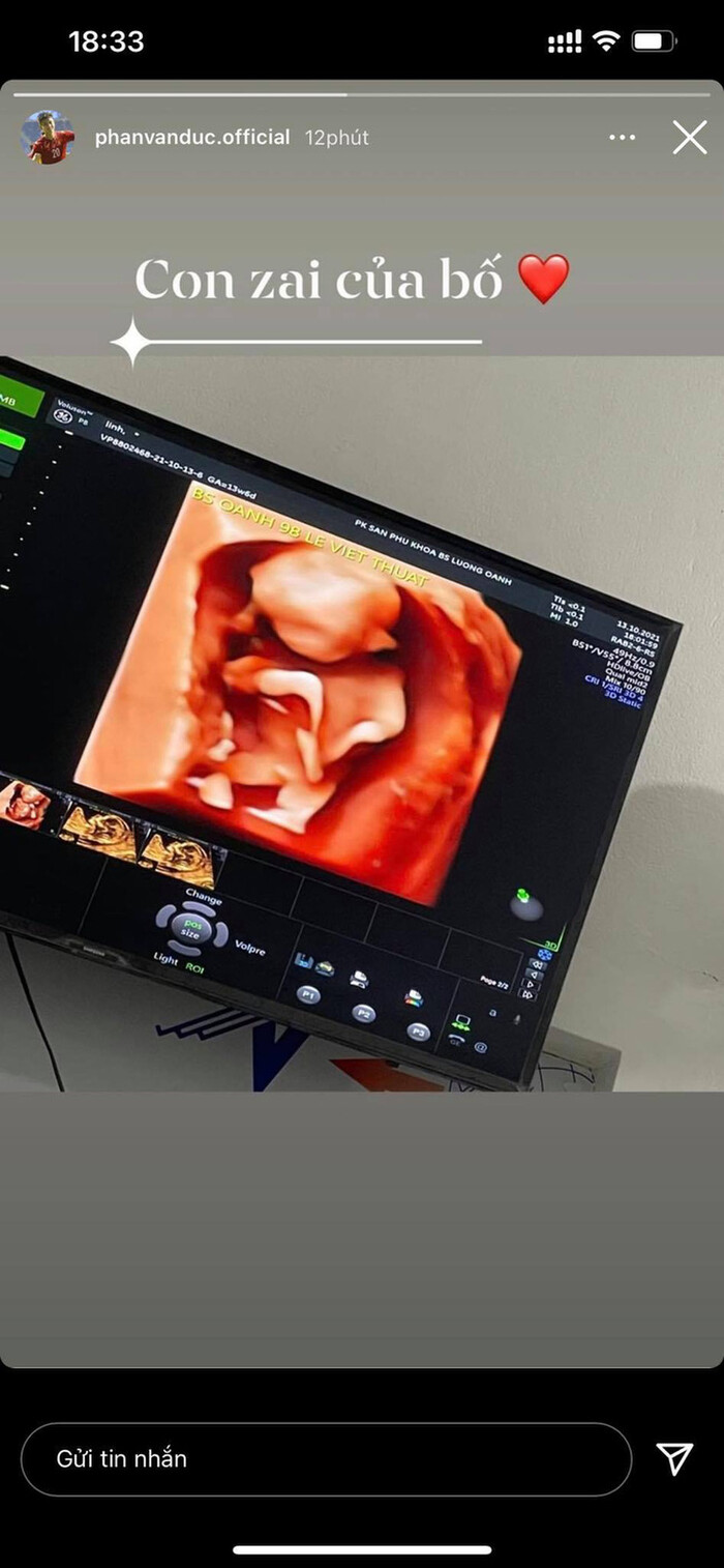 Phan Văn Đức tạo bụng bầu tặng nàng WAGs Nhật Linh sắp sinh quý tử - 1 Phan Văn Đức tạo bụng bầu tặng nàng WAGs Nhật Linh sắp sinh quý tử - 1