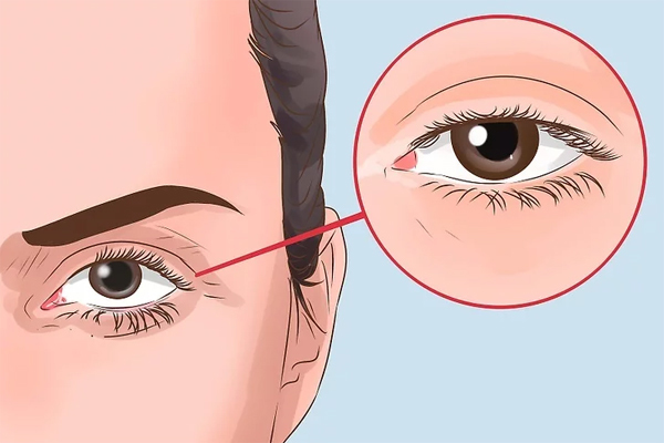Dấu hiệu trên mặt cảnh báo thận bất ổn Dấu hiệu trên mặt cảnh báo thận bất ổn