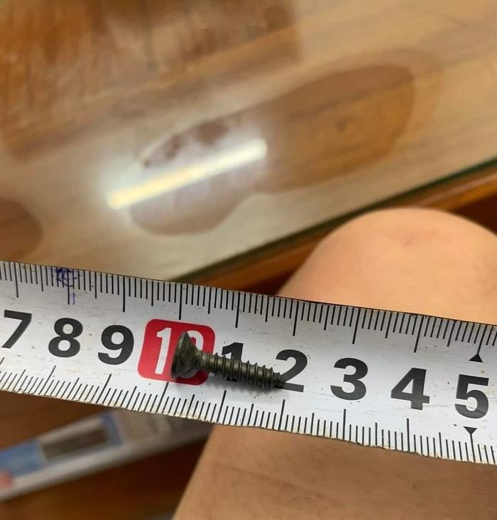 Dị vật sau khi ra khỏi cơ thể bệnh nhi.