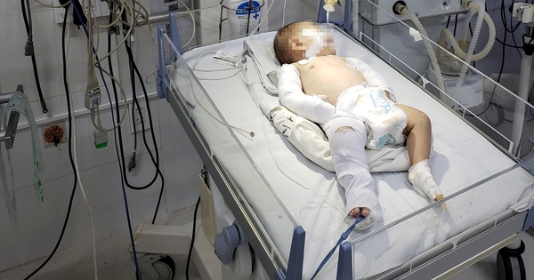 Bé gái 3 tháng tuổi bị bạo hành chấn thương sọ não: Mẹ và người tình đều dương tính ma túy