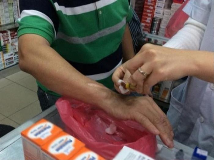 NSƯT Chí Trung băng bó chấn thương vùng tay